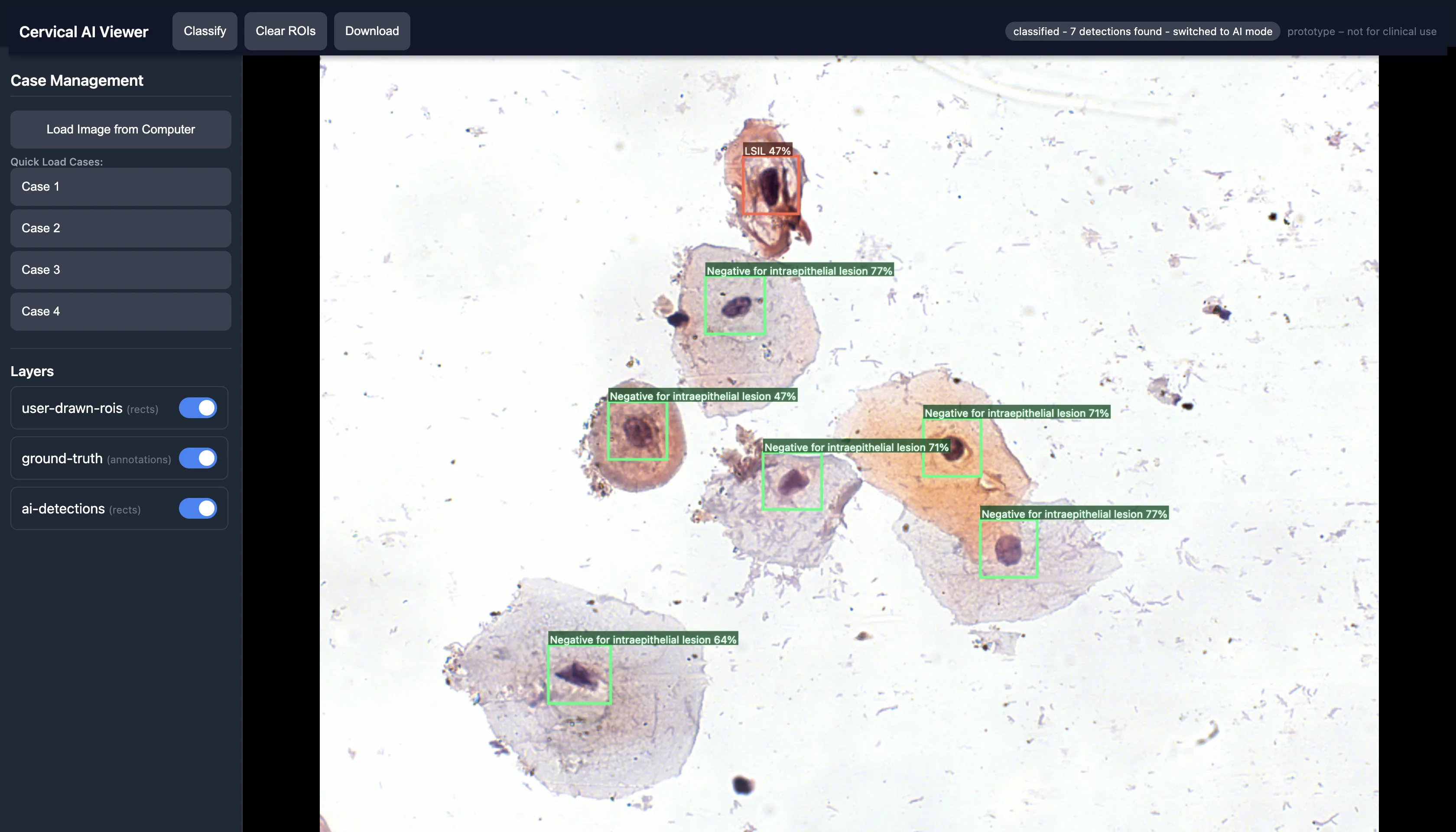 Cervical Screening Decision Support Platform